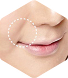 上眼睑