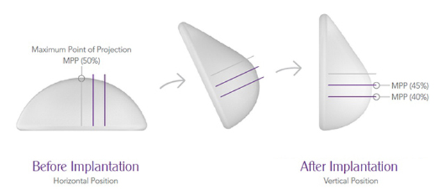 rue Tissue Technology™